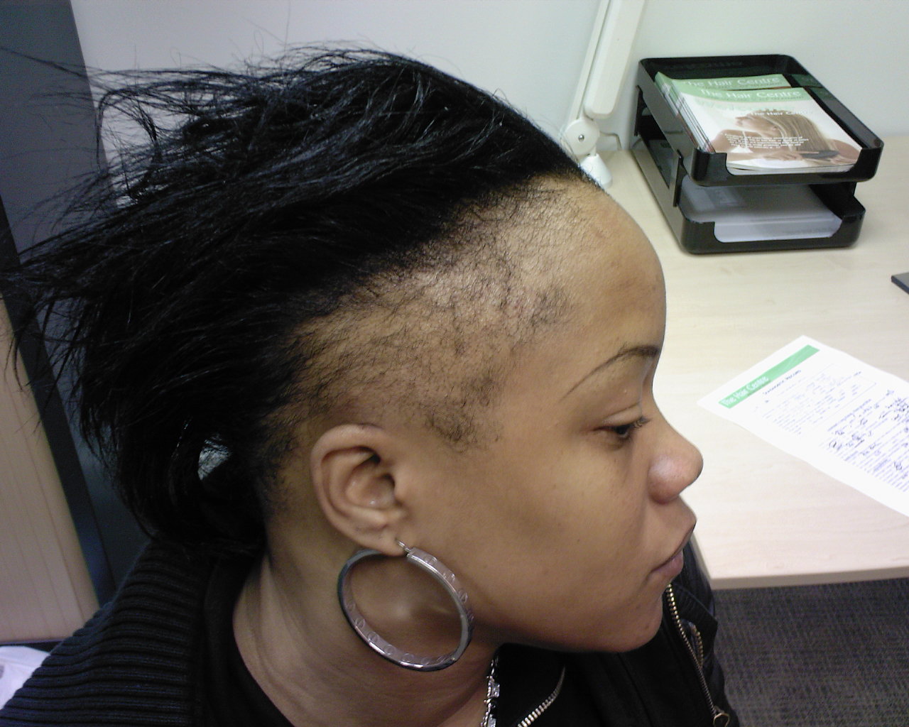 Image result for bad women hairline